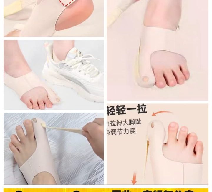 腳趾拇指外翻矯正器~$15